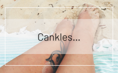 Cankles…